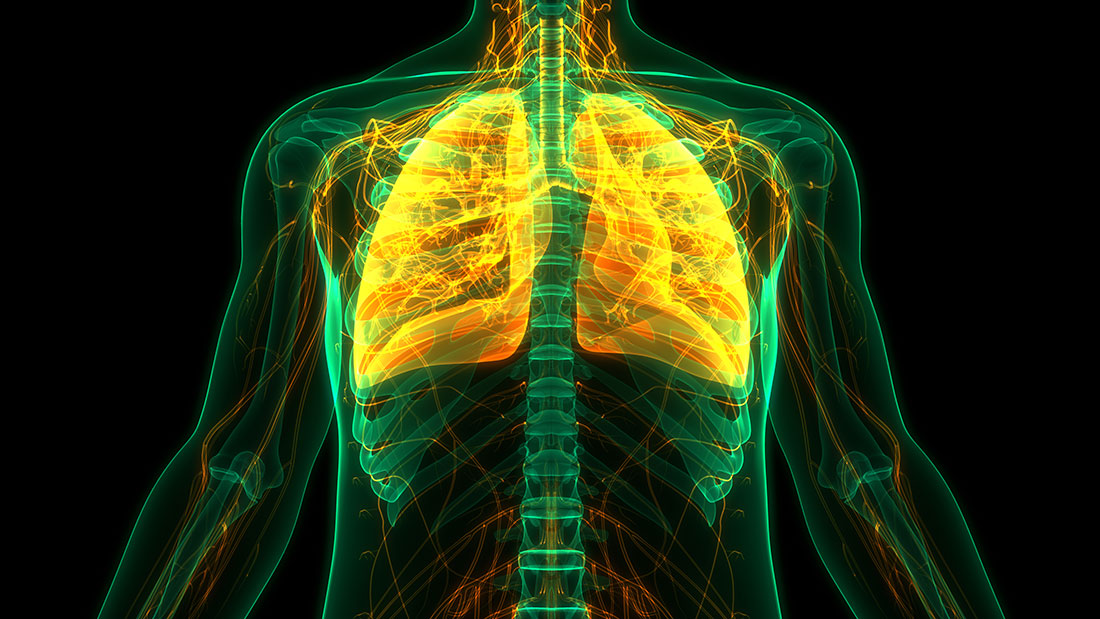 Illustrated image of chest X-ray